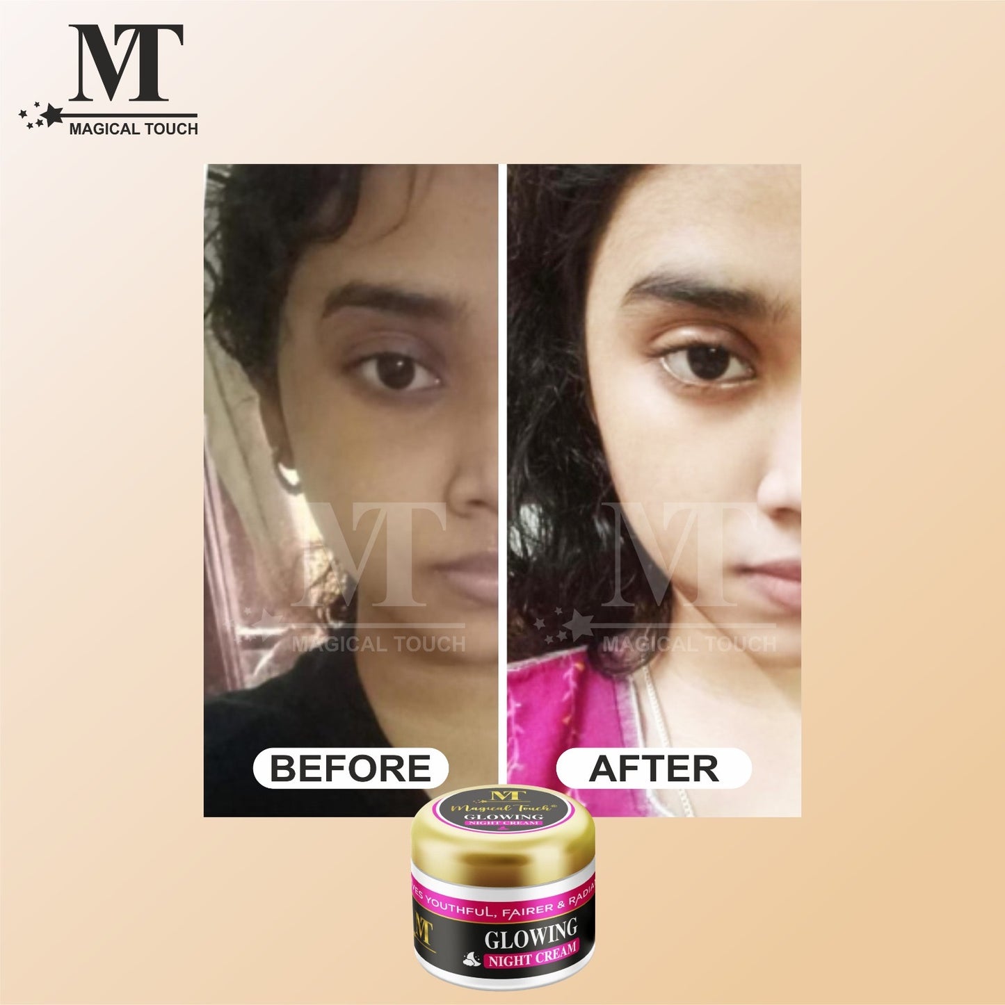 Magical Touch Glowing Night Cream for Bright Skin | Skin Whitening, Repair & Hydration Formula | Removes acne pimples and dark spots (7 days results)