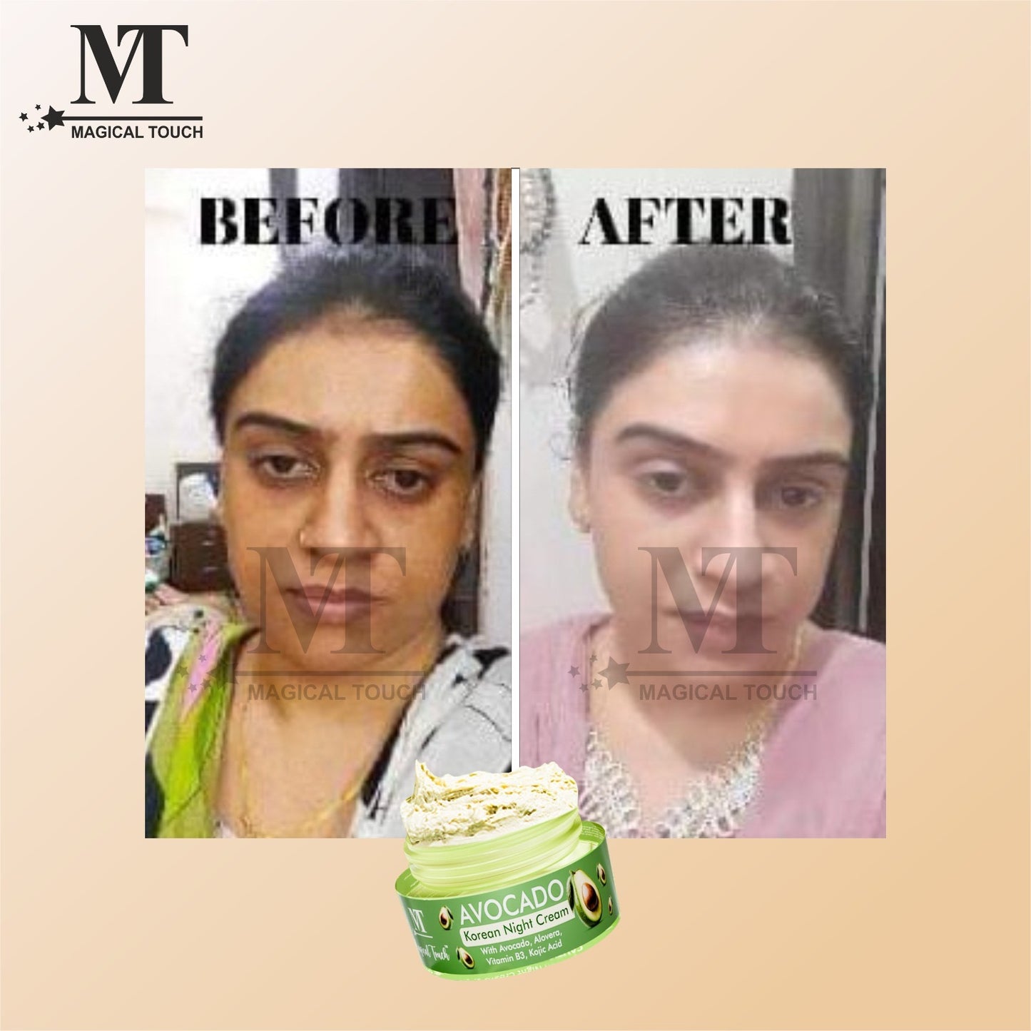 Avocado Korean Night Cream | Skin Brightening and Whitening | Results in 7 Days (50 gms)
