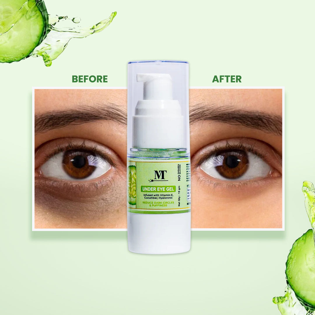 UNDER EYE GEL (reduce 100% dark circles & finelines) & ๐๐
๐ซ๐๐ ๐๐ฎ๐ซ๐ฉ๐ซ๐ข๐ฌ๐ ๐๐ข๐๐ญ๐