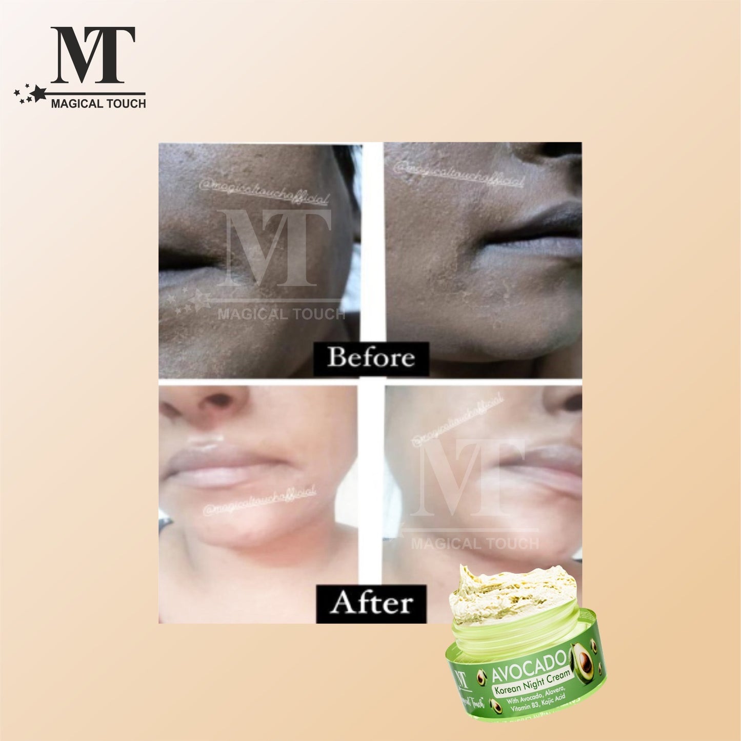 AVOCADO KOREAN NIGHT CREAM &  🎁𝐅𝐫𝐞𝐞 𝐒𝐮𝐫𝐩𝐫𝐢𝐬𝐞 𝐆𝐢𝐟𝐭🎁