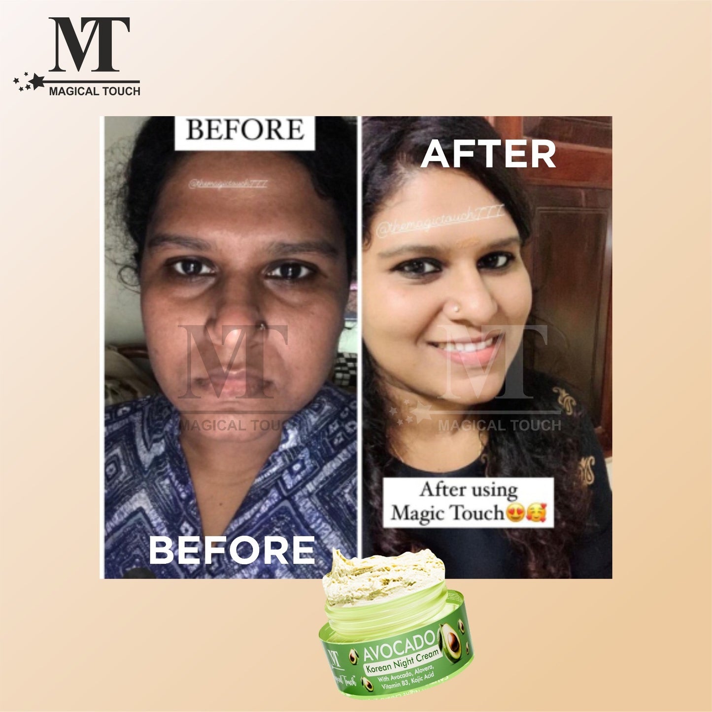 (Buy 2 Get 1) Avocado Korean Night Cream | Skin Brightening and Whitening | Results in 7 Days (30 gms)