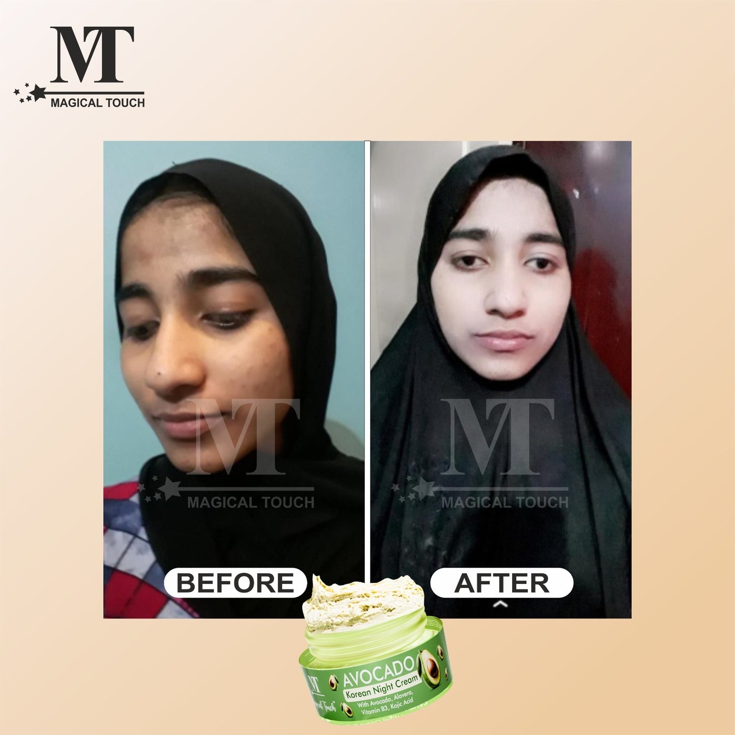 (Buy 2 Get 1) Avocado Korean Night Cream | Skin Brightening and Whitening | Results in 7 Days (30 gms)