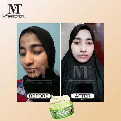 (Buy 2 Get 1) Avocado Korean Night Cream | Skin Brightening and Whitening | Results in 7 Days (30 gms)