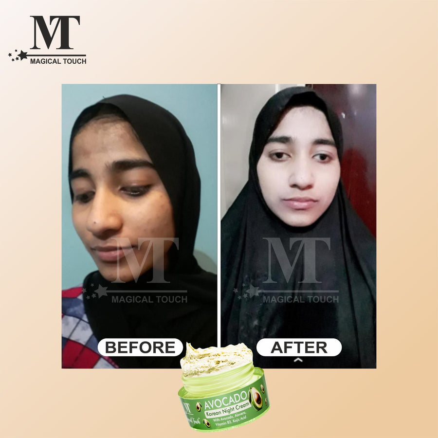 product slider image