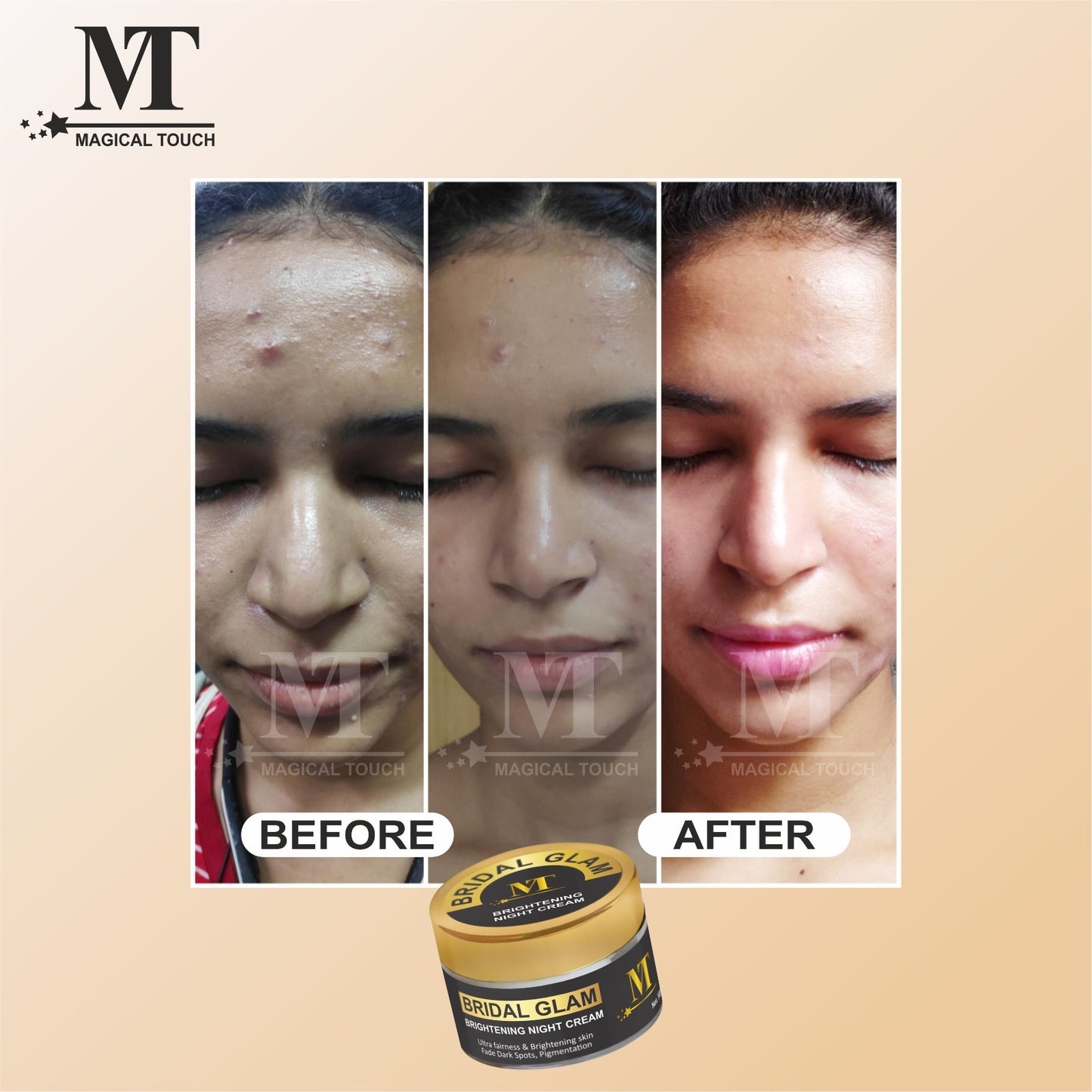 Buy 2 Get 1 Free Bridal Glam Korean Night Cream – 7 Days Results Challange