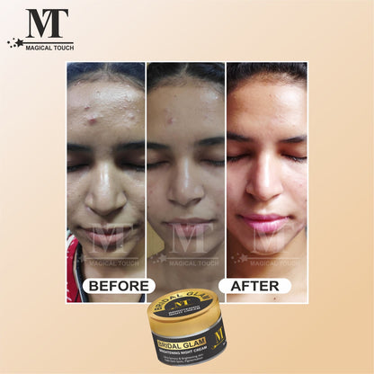 Buy 2 Get 1 Free Bridal Glam Korean Night Cream – 7 Days Results Challange