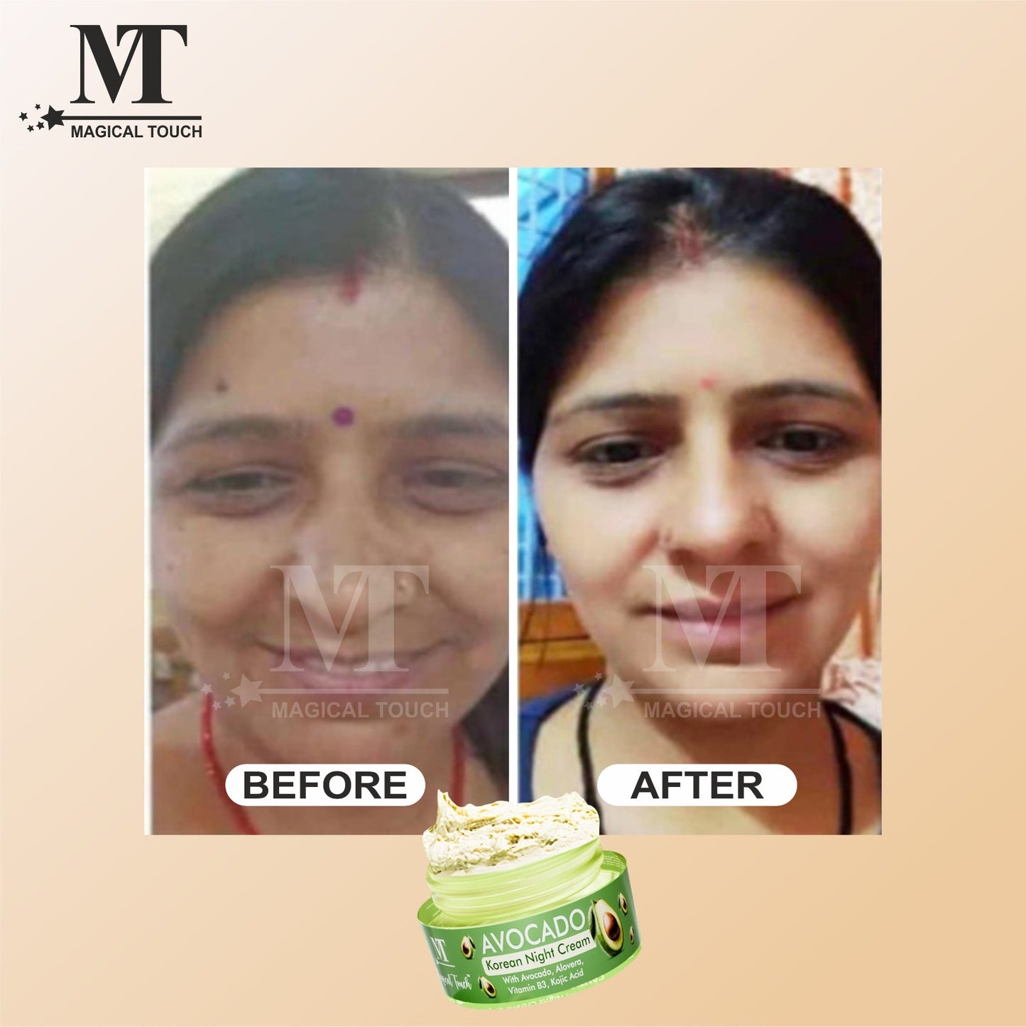 (Buy 2 Get 1) Avocado Korean Night Cream | Skin Brightening and Whitening | Results in 7 Days (30 gms)