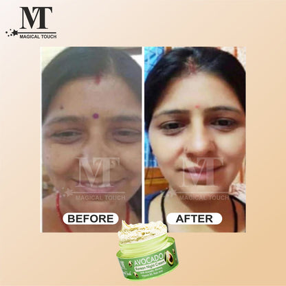 (Buy 2 Get 1) Avocado Korean Night Cream | Skin Brightening and Whitening | Results in 7 Days (30 gms)