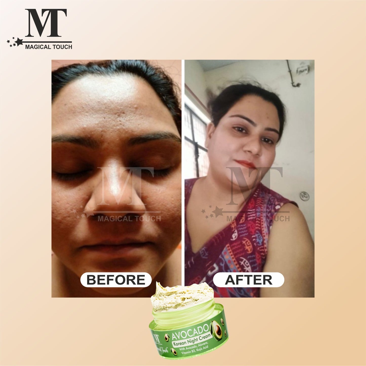 (Buy 2 Get 1) Avocado Korean Night Cream | Skin Brightening and Whitening | Results in 7 Days (30 gms)