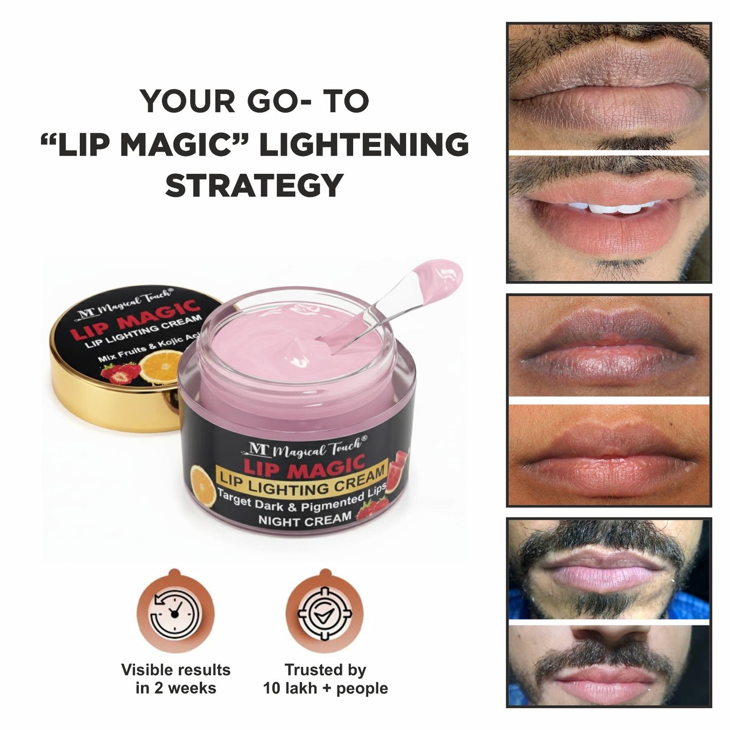 LIP LIGHTENING CREAM - 7 days visible results. Remove dark lips, pigmented lips, smoking lips and make soft clear and pinkish lips (30 gms)