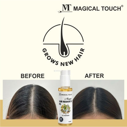 MAGIC HAIR REGROWTH OIL - Reduces Hair Fall, Nourishes the scalp, Promotes healthy hair regrowth naturally .