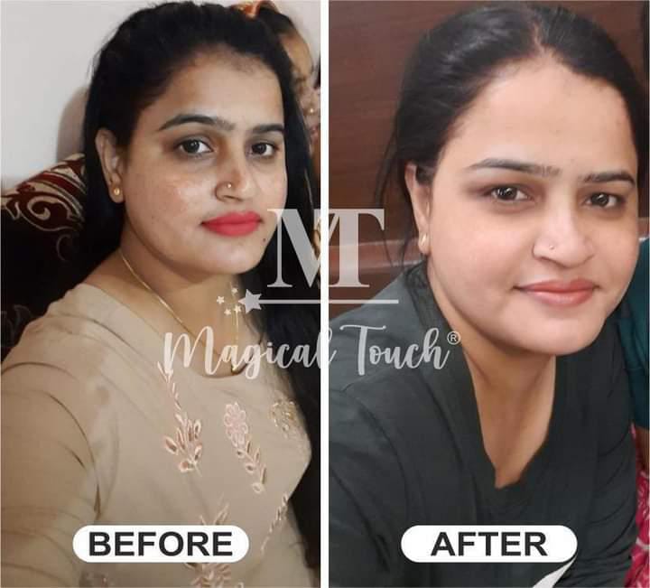 BRIDAL GLOW KIT (NIGHT CREAM + FACEWASH + SERUM+ SCRUB)