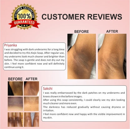 Pack of 3 Full Body Whitening Kojic Soap | Pigmentation & Spots lightening - (2 weeks results)